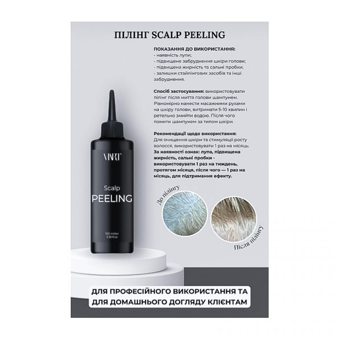 Пилинг Viart Scalp Peeling для деликатной очистки кожи головы, 100 мл Пилинг Viart Scalp Peeling для деликатной очистки кожи головы, 100 мл
